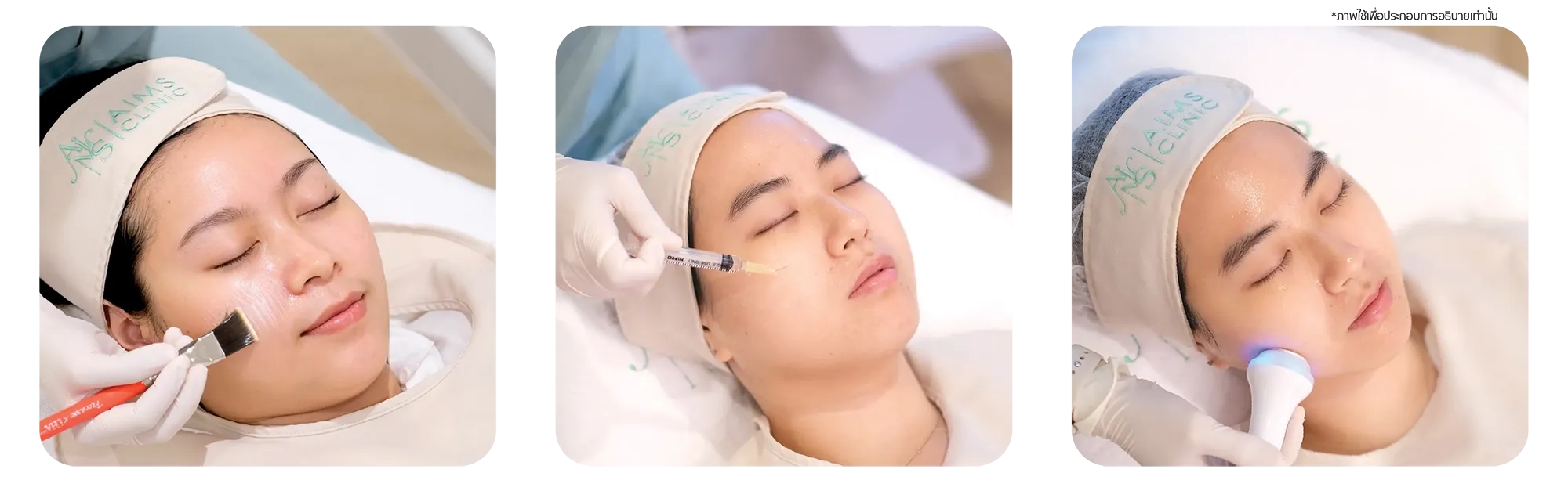 Treatment_Laser-08.webp